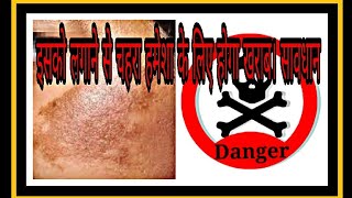 Hindi Most Dangerous Skin Lightening Cream चहरा गोरा बनाने वाली सबसे ख़तरनाक क्रीम june 2018 [upl. by Sana]