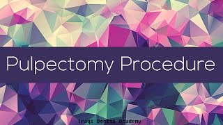 Pulpectomy Procedure Overview [upl. by Aduh]