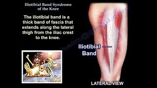 Iliotibial Band Syndrome Of The Knee  Everything You Need To Know  Dr Nabil Ebraheim [upl. by Pride]