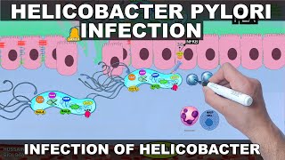 Helicobacter Pylori Pathogenesis  Detailed [upl. by Nonnarb688]