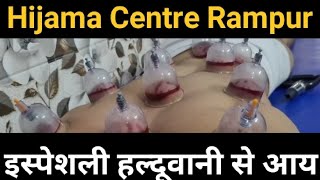 Hijama Centre Rampur [upl. by Ennyletak]