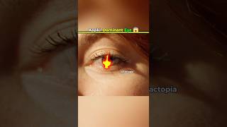 Aapki Dominant Eye Konsi Hai 😱 shorts fact factoholic eyes [upl. by Beghtol]