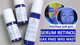 Kupas tuntas Kiehls Retinol Skin Renewing Daily Micro Dose Serum Anti aging gentle terbaik… [upl. by Notlaw]