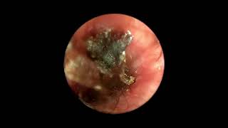 Ear Mites Inside Dog’s Ear Canal Video Otoscopy [upl. by Herson]