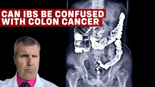 IBS vs Colon Cancer Understanding the Differences and Similarities [upl. by Yelsel]