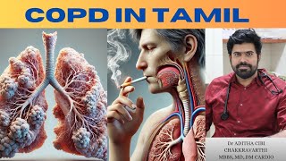 COPD EXPLAINED IN TAMIL [upl. by Adnerad387]