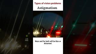 Types of Vision problems  Blurred vision eyecareoptom5506 short shorts trending eye glasses [upl. by Waki]