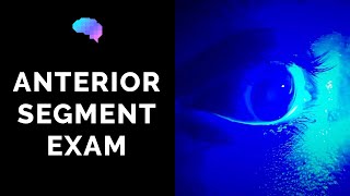 Anterior Segment Examination of the Eye  OSCE Guide  UKMLA  CPSA [upl. by Ahsaten]