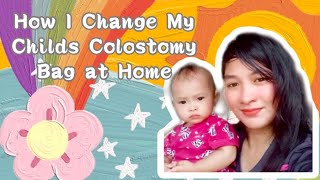 How To Change Colostomy Bag  Paano Mag Palit Ng Colostomy Bag [upl. by Swift]