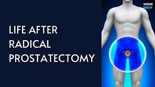 Life After Radical Prostatectomy [upl. by Yren589]