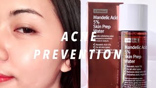 MANDELIC ACID 5 SKIN PREP WATER BY WISHTREND  HOW TO TREAT ACNE TINY BUMPS DULL SKIN [upl. by Neff]