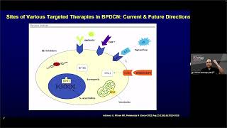 Advances in the Diagnosis and Treatment of BPDCN – Dr Naveen Pemmaraju May 2627 2023 [upl. by Yle933]