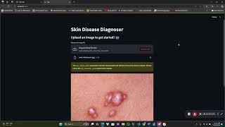 Skin Diseases Diagnoses AI [upl. by Yi157]