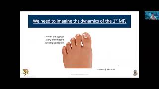 Rethinking First Metatarsal Phalangeal Joint Disease [upl. by Base]