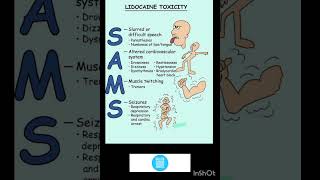 Lidocaine Toxicity nursing ytshortsnorcet [upl. by Nosak]