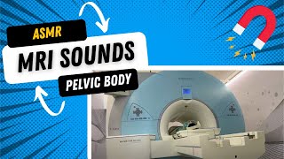 🎧🧲 ASMR Pelvic Body MRI Sounds Siemens Magnetom Avanto 15T Magnet [upl. by Gussy]