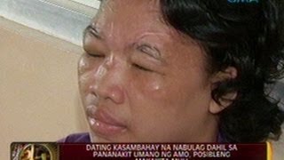 24 Oras Dating kasambahay na nabulag dahil sa pananakit umano ng amo posibleng makakita muli [upl. by Loy]