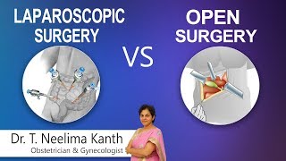 Hi9  Laparoscopic Surgery vs Open Surgery  Dr T Neelima Kanth Obstetrician amp Gynecologist [upl. by Llyrehc]