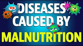 Diseases Caused by Malnutrition [upl. by Louis498]