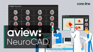 KOR AVIEW NeuroCAD Introduction [upl. by Dart646]