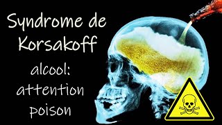 Les dangers de lalcool sur le cerveau syndrome de Wernicke Korsakoff un témoignage [upl. by Aihsenal]