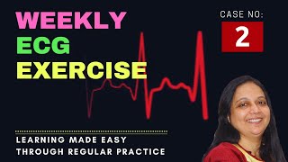 Weekly ECG exercise Case 2 [upl. by Brasca]