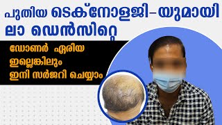 ഒരൊറ്റ ദിവസം കൊണ്ട് ഇങ്ങനെ മുടി വളരും  La Densitae Hair Transplant Clinic  Kochi  Trivandrum [upl. by Wollis]