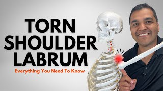 Torn Shoulder Labrum Everything You Need To Know Diagnosis amp Treatment [upl. by Cotterell]