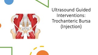 ultrasound Guided Interventions Trochanteric Bursa Injection fyp sport sports sportsmedicine [upl. by Enomyar]