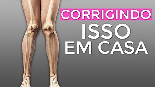 Como corrigir o Joelho VALGO  Joelho para DENTRO Em CASA 3 Exercícios [upl. by Scuram]