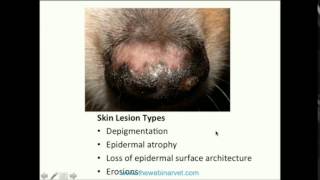 Case Based Approach to Skin Lesion Identification and Biopsy site selection [upl. by Stahl519]