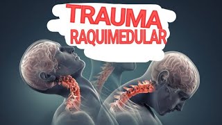 TRM Traumatismo Raquimedular [upl. by Adnarahs]