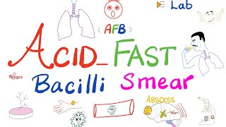 Acid Fast Bacilli Smear AFB smear for tuberculosis TB  Labs 🧪 [upl. by Rednave102]