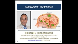 RADIOLOGY OF MENINGIOMA [upl. by Emad206]