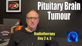 Does Radiotherapy Cause Side Effects Days 2 and 3 [upl. by Nodaj]