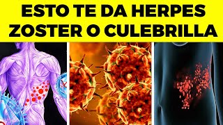 ¡ALERTA Este error común CAUSA herpes zóster o culebrilla  no lo hagas [upl. by Redmund]