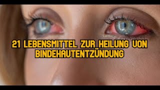 21 Lebensmittel zur Heilung von Bindehautentzündung [upl. by Lemmuela173]