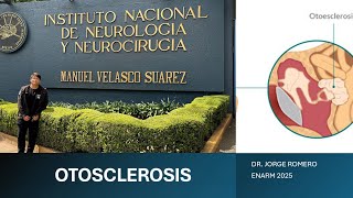 OTOSCLEROSIS  ENARM 2025  GPC [upl. by Ttenyl897]