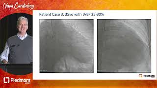 Appraisal of Successes and Shortfalls in CTO Revascularization [upl. by Acinomahs260]