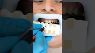 DENTIST APPROVED Teeth Whitening ASMR Experience [upl. by Cosenza]