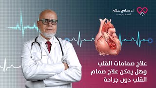 علاج صمامات القلب وهل يمكن علاج صمام القلب دون جراحة  دكتور سامح علام [upl. by Sidalg]