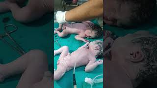 First cry baby at birthmaa shortvideo baby cutebaby status babyvideos cute nurse touching [upl. by John]