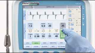 fabian HFO SIPPV Synchronized Intermittent Positive Pressure Ventilation [upl. by Orlena768]