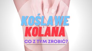 KOŚLAWE KOLANA  co z tym zrobić [upl. by Aihsatan283]