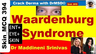 Waardenburg Syndrome  Forelock  Albinism  Piebaldism  Deafness Heterochromia Iridis  Dystopia [upl. by Caesaria]