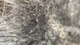 ITCHY DRY FLAKY SCALP  FLAKY DANDRUFF  HAIR SCRATCHING ASMR [upl. by Aires]