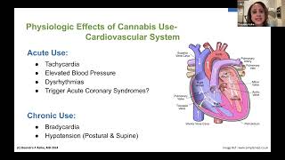 Communicating Cannabis Use Before Surgery [upl. by Neil277]