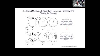 The differential sensitivities of EEG and MEG to their neuronal generators [upl. by Kowal]