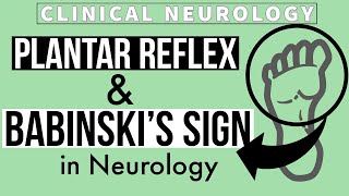 PLANTAR REFLEX  BABINSKIs SIGN  Equivocal Plantar  Other methods  Clinical Neurology [upl. by Abih]