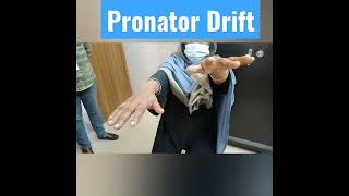 Pronator Drift a subtle motor weakness indicating Stroke  Shorts [upl. by Aural]